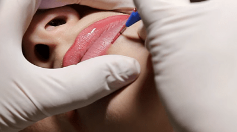 Microblading de labios